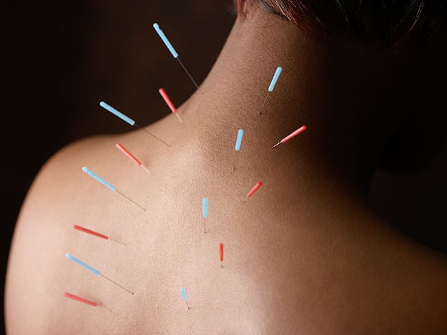 How does acupuncture give effects on low back pain? Should I give it a try on it since I have a severe low back pain?