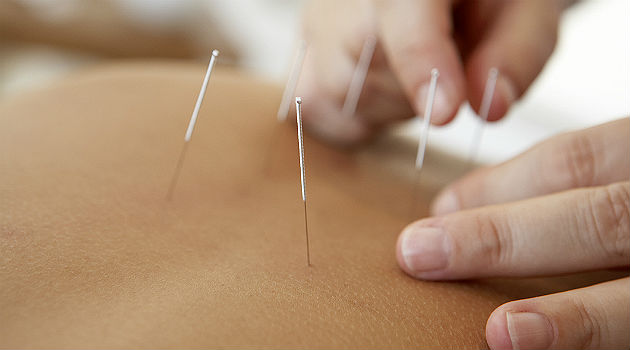 How-effective-is-acupuncture-for-back-pain